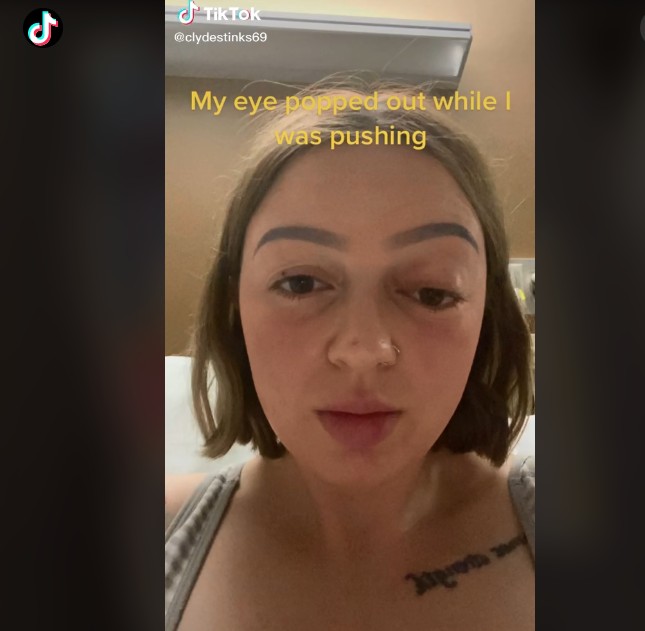Mãe compartilhou vídeo que mostra como ficou seu olho após o trabalho de parto (Foto: Reprodução/TikTok/Bethany Collins)