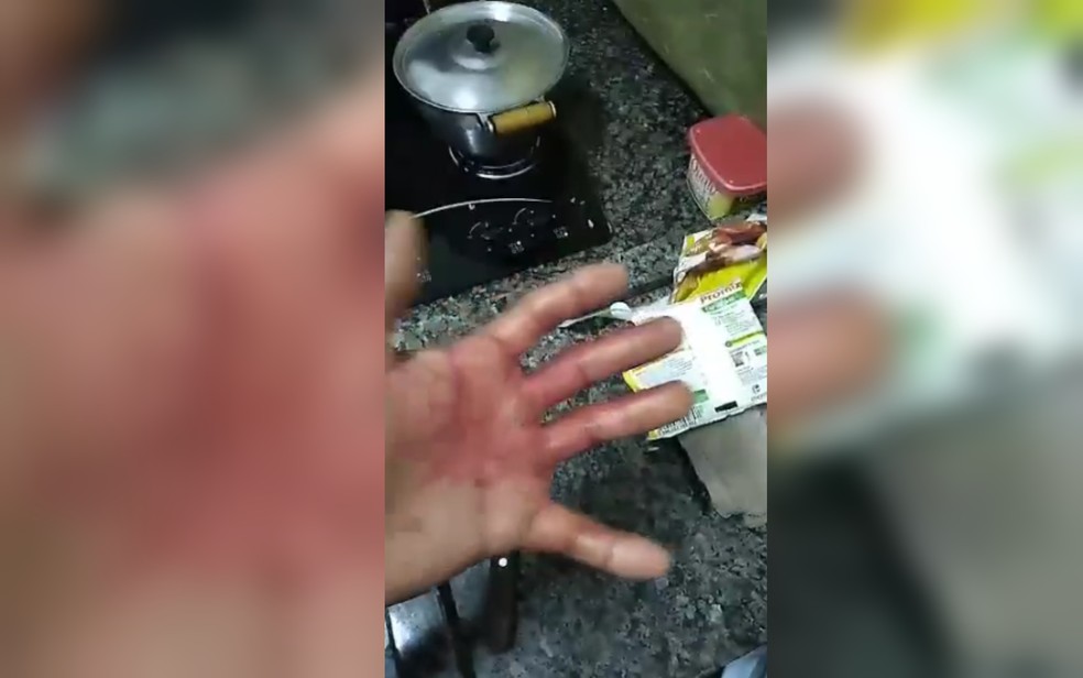 Homem filma mo cheia de sangue aps esfaquear outro homem em Terezpolis, Gois  Foto: Reproduo/TV Anhanguera