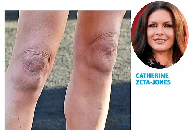 Galeria Os Joelhos Bizarros Das Famosas