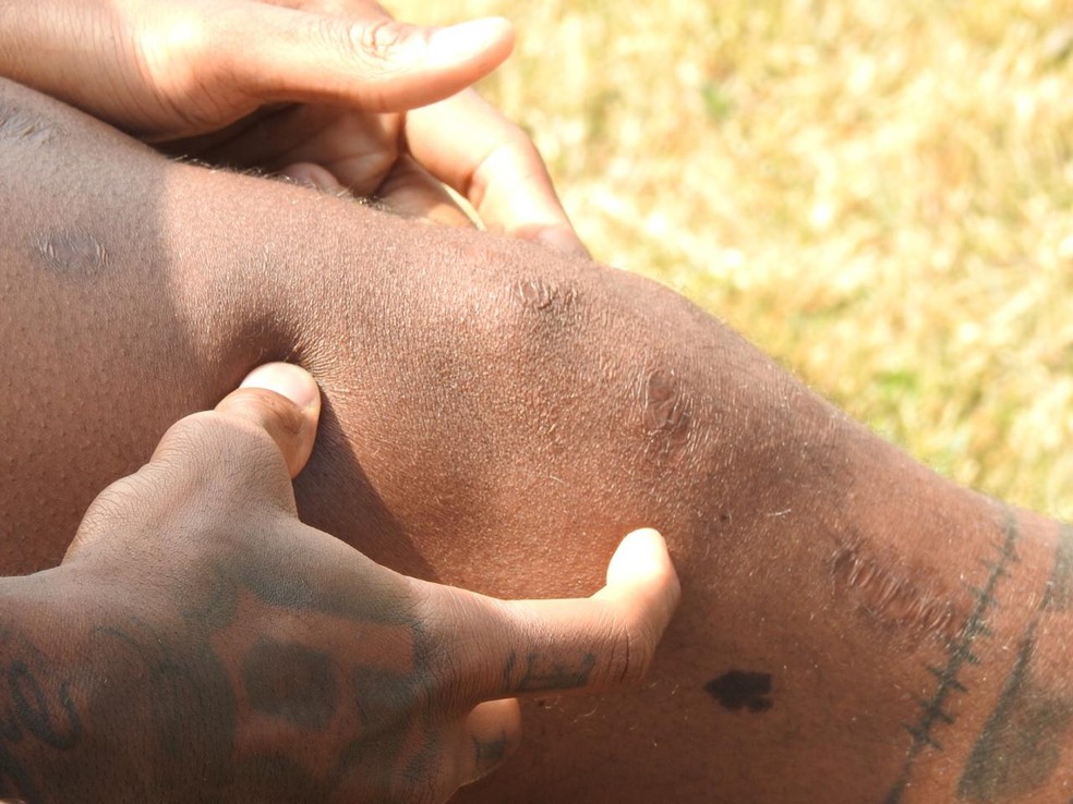 Renê Júnior, volante do Corinthians, mostra cicatriz no joelho esquerdo — Foto: Marcelo Braga