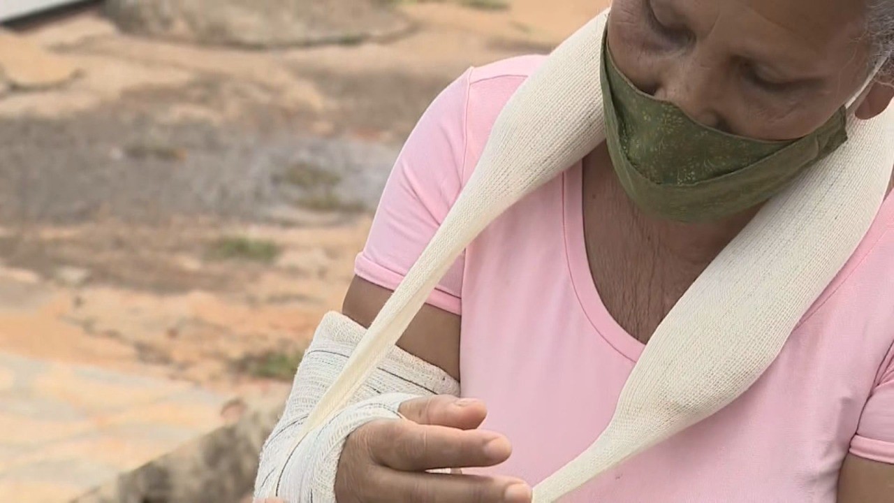 Idosa de 60 anos quebra o braço ao escorregar em óleo de caminhão em obra da Saecil em Leme