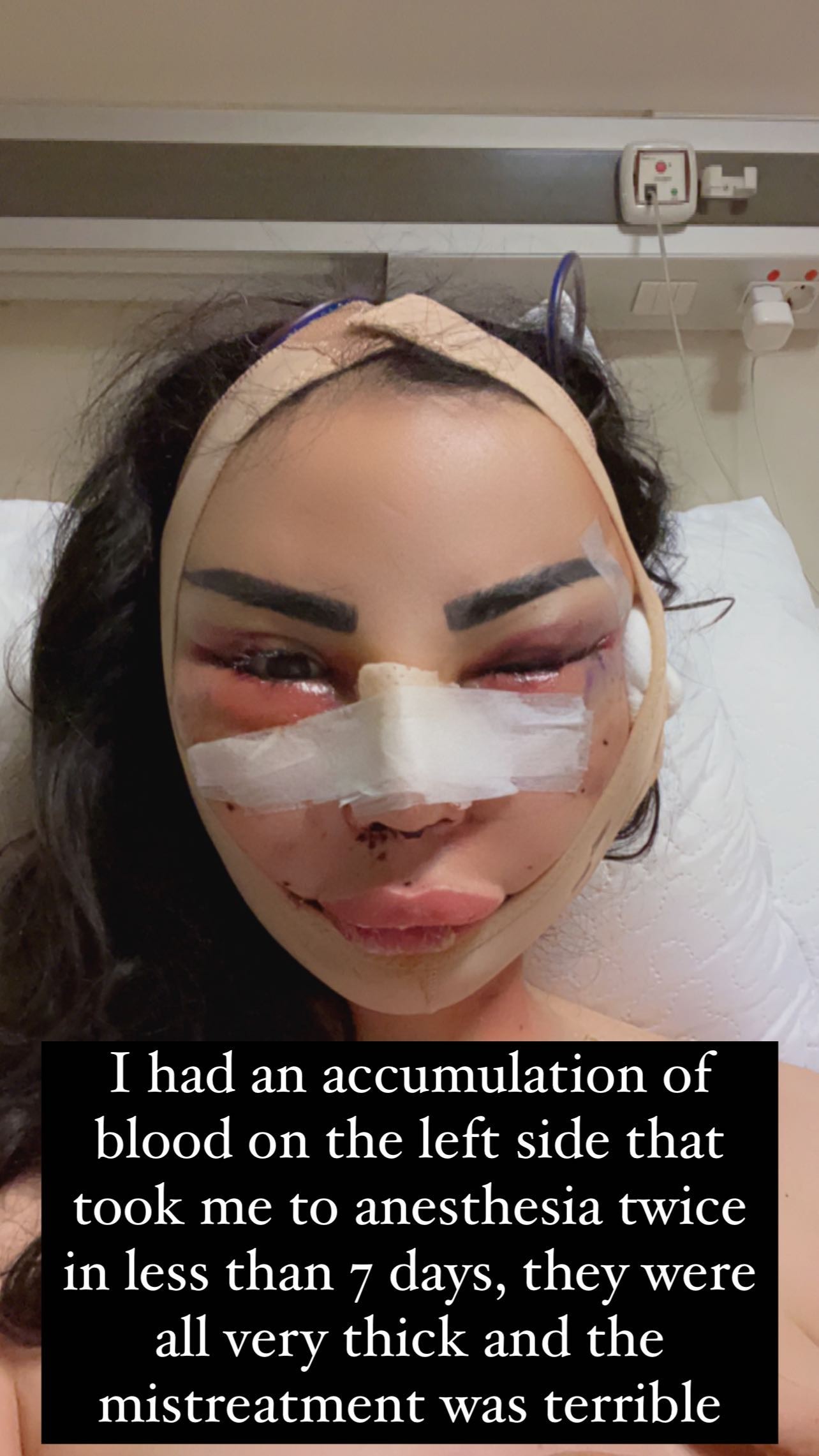 Modelo Jennifer Pamplona denuncia violência cirúrgica na Turquia (Foto: Reprodução/Instagram)