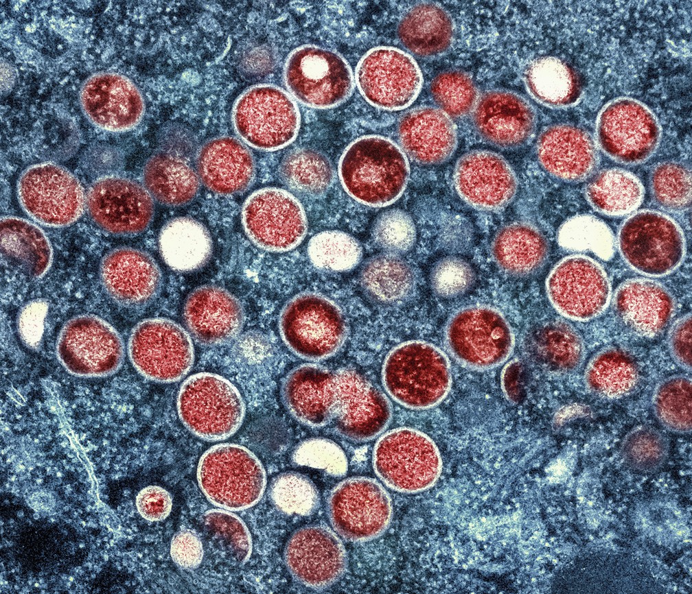 Vírus da monkeypox visto usando microscopia. — Foto: NIAID via AP, File