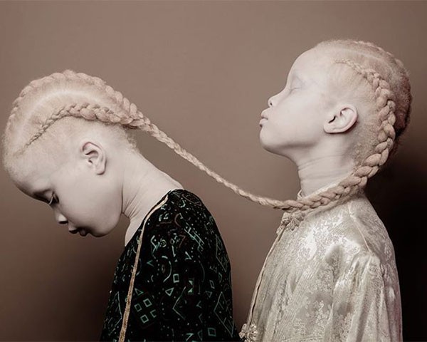 As gêmeas têm chamado atenção na moda (Foto: Vinicius Terranova)