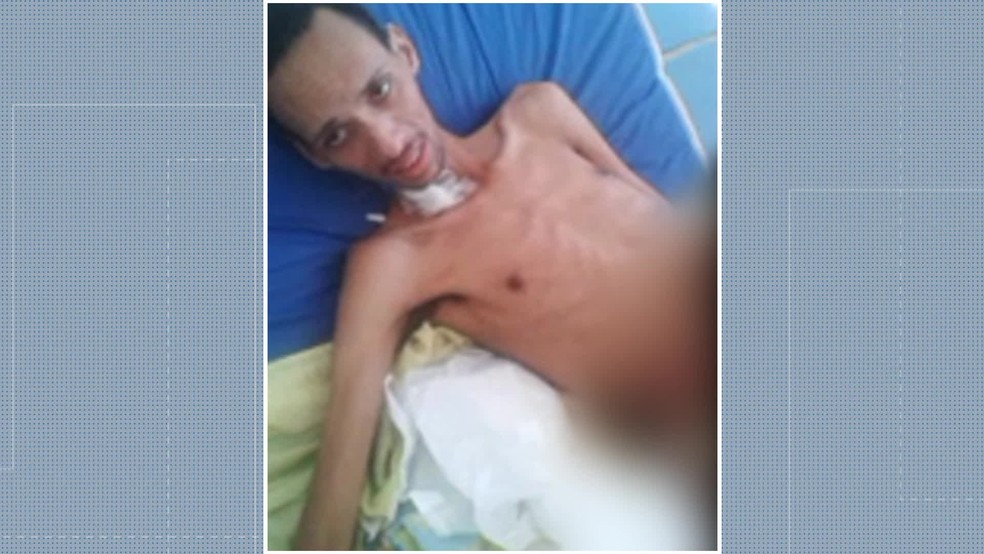Tio fez imagem de Thiago com intestino aberto em maca do Hospital Albert Schweitzer, em Realengo, na Zona Oeste do Rio â€” Foto: ReproduÃ§Ã£o/ TV Globo