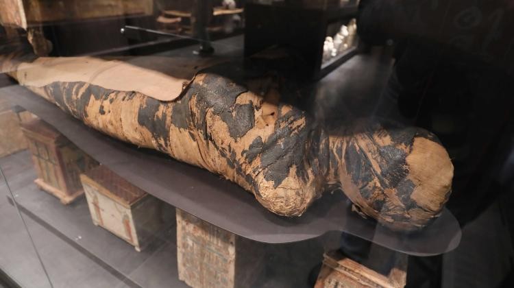 Mulher mumificada no Museu Nacional de Varsóvia (Foto: Pawel Supernak/ Galeria de Arte Antiga de Varsóvia)