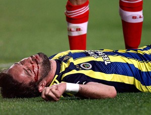 Gokhan Gonul sangue Fenerbahçe caído jogo Benfica (Foto: Reuters)