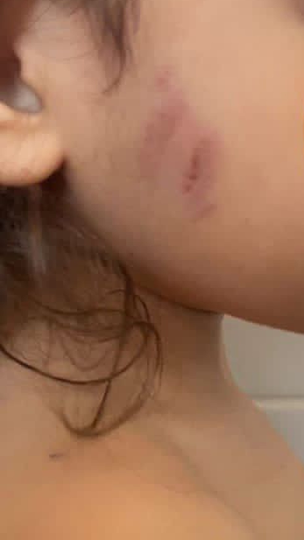 Além de feridas no rosto, criança sofreu mordidas e arranhões pelo corpo.  — Foto: Arquivo pessoal 