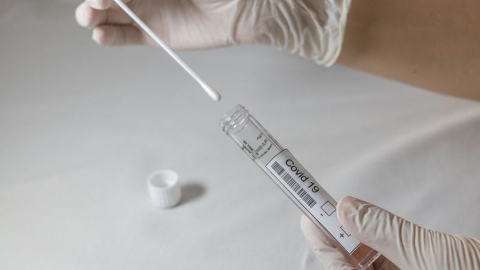 Material colhido no exame RT-PCR pode ser também usado no sequenciamento genético para identificar variantes, como foi feito em São Paulo — Foto: Okan Celik/Getty Images via BBC