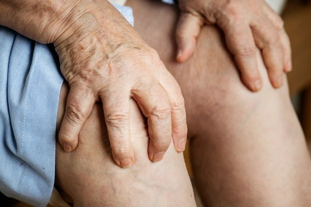 Varizes em idosos: prevenção e tratamentos