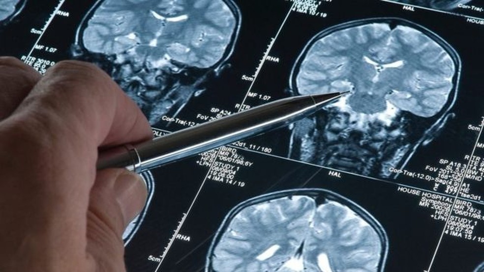 Pesquisas sobre Alzheimer estão melhorando as perspectivas para pacientes com demência em todo o mundo — Foto: GETTY IMAGES/BBC