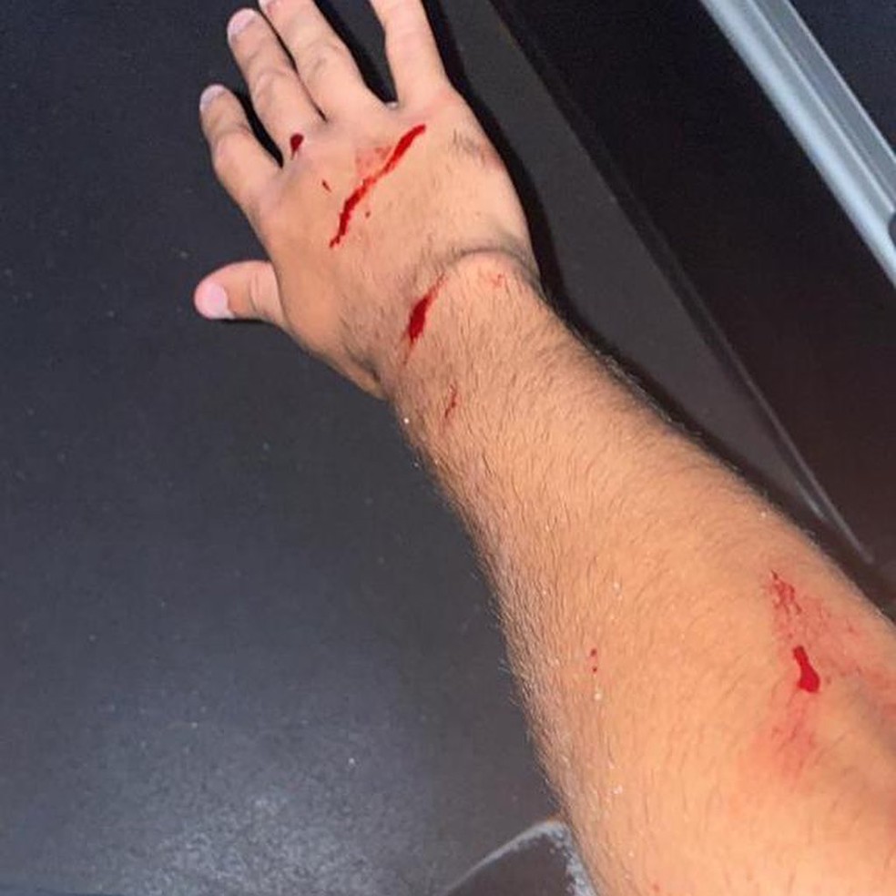 Estilhaços cortaram o braço do meia Locatelli  — Foto: Reprodução Redes Sociais 