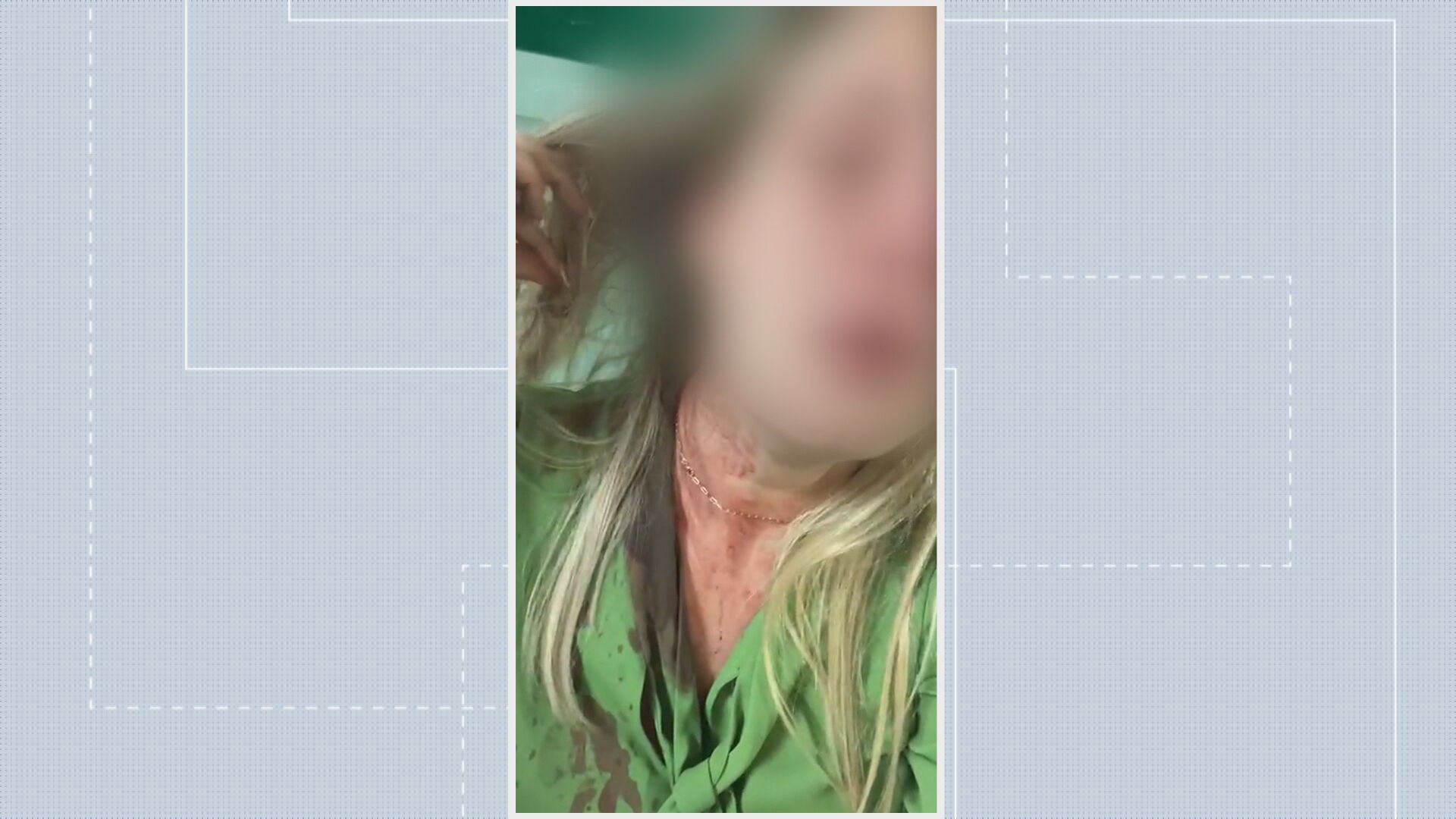 Mulher é agredida ao buscar filha na casa da família do ex-marido, em Brasília