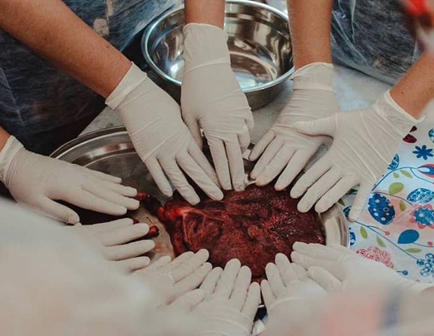 Alunas e placenteiras manipulando a placenta durante curso. (Foto: Reprodução Facebook / @bara.bada)