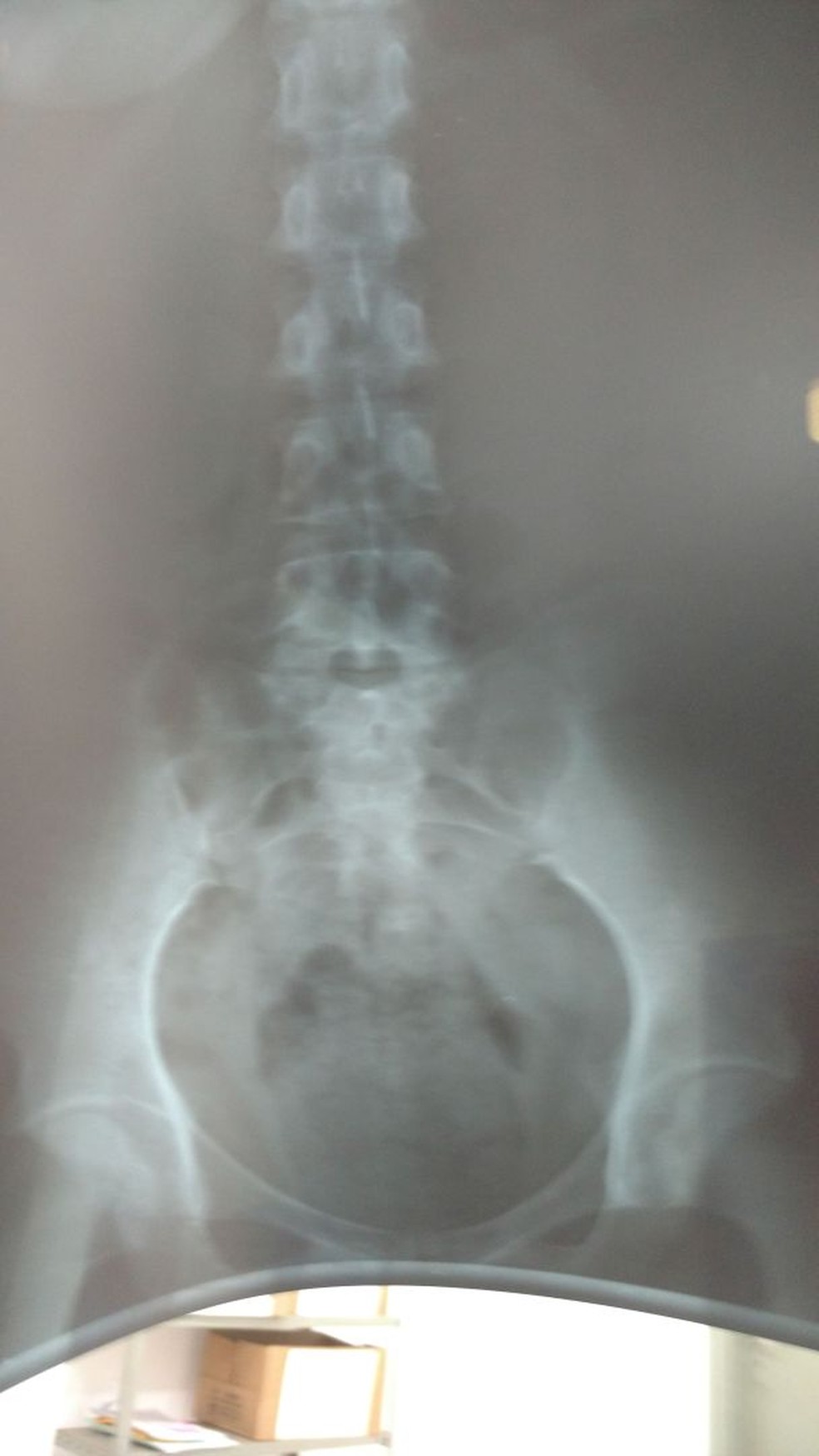Exame de raio-x realizado na suspeita de tráfico em MS (Foto: Polícia Civil/Divulgação)