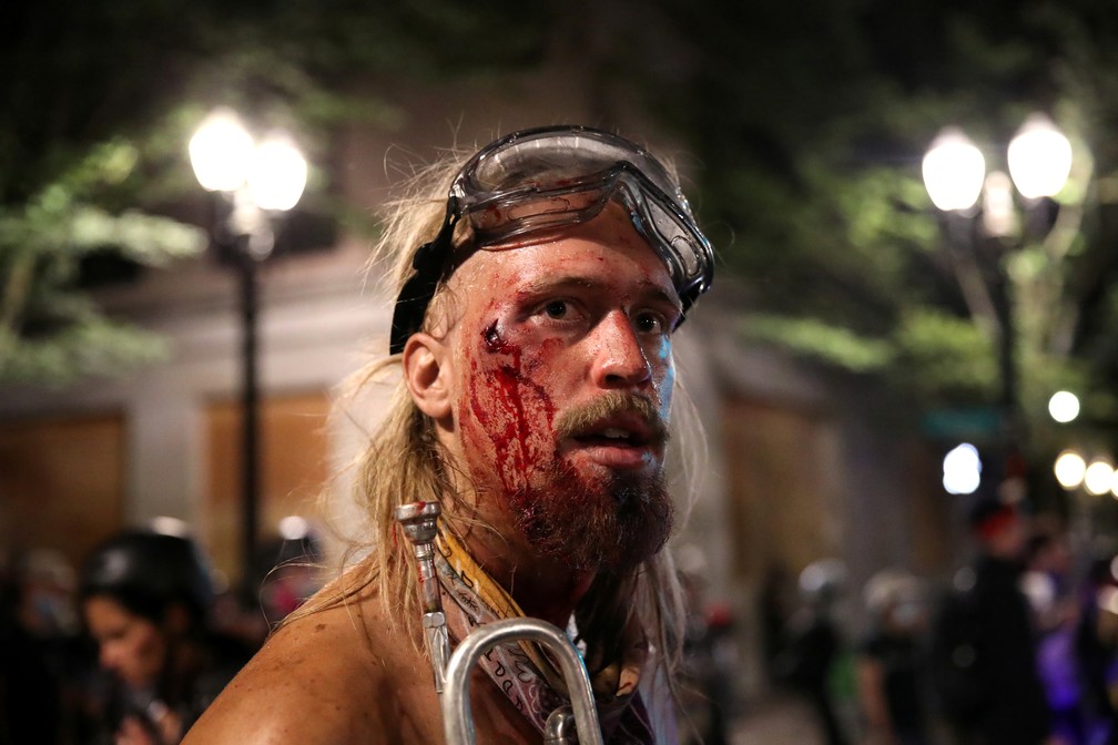 Manifestante ferido em protesto em Portland, na madrugada desta segunda (27) — Foto: Reurters/Caitlin Ochs