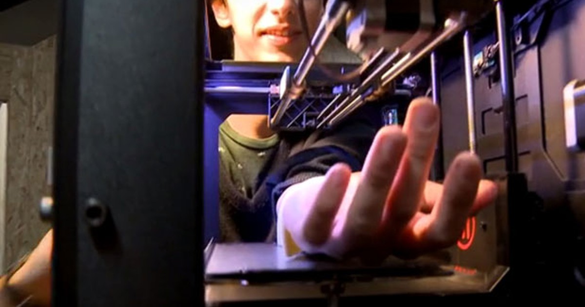 G1 – Les Français adaptent une imprimante 3D pour faire des tatouages