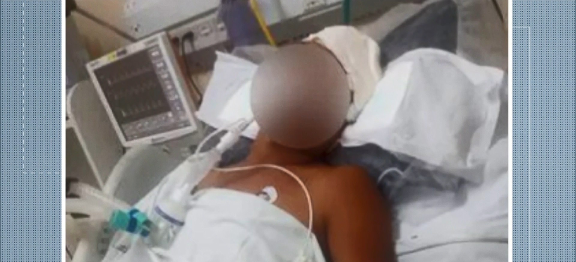 Venezuelano é internado em estado grave após ser agredido por homem no ES