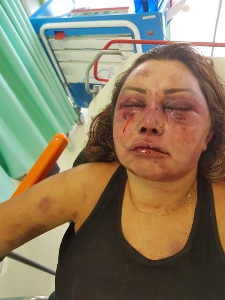 Elaine Peres Caparroz foi espancada por um homem em seu primeiro encontro (Foto: Reprodução)
