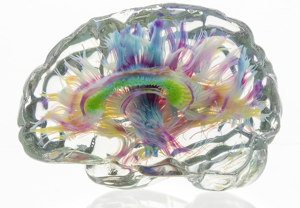 Voxel, Impressão 3D. Curve and graph data processing workflows and their representative 3D-printed models. White matter tractography data of the human brain, created with the 3D Slicer medical image processing platform (37), visualizing bundles of axons,  (Foto: The Mediated Matter Group/MIT)