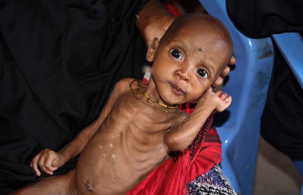 Segundo Unicef, a seca na Somália pode levar a até 270 mil crianças sofrerem de desnutrição grave neste ano — Foto: Farah Abdi Warsameh/AP