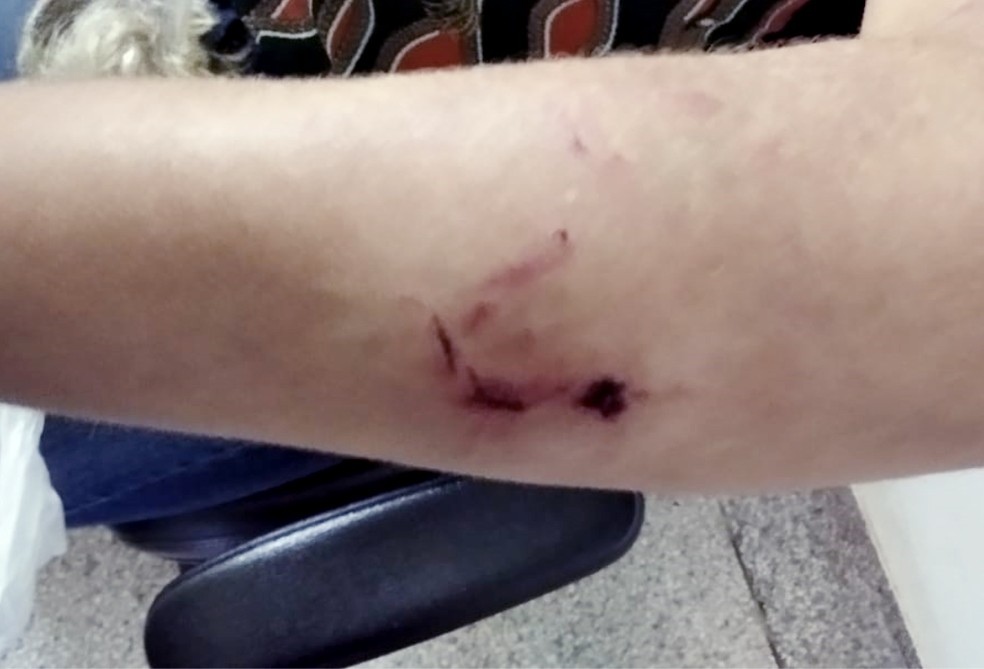 Mulher disse que foi agredida pelo companheiro com socos e pauladas — Foto: Polícia Militar