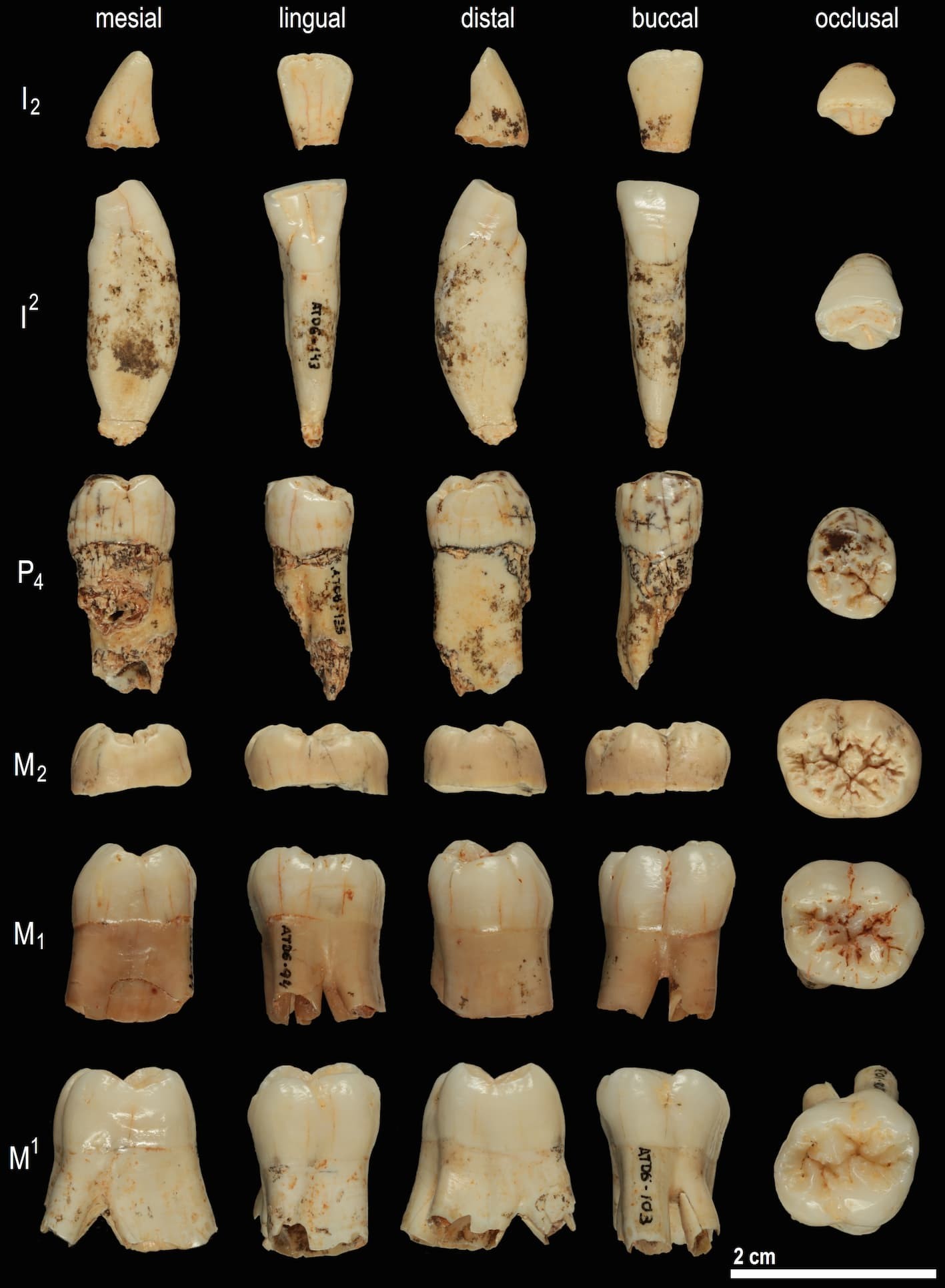 Pesquisadores conseguiram sequenciar proteínas presentes em dente de um Homo antecessor (Foto: Professor José María Bermúdez de Castro)