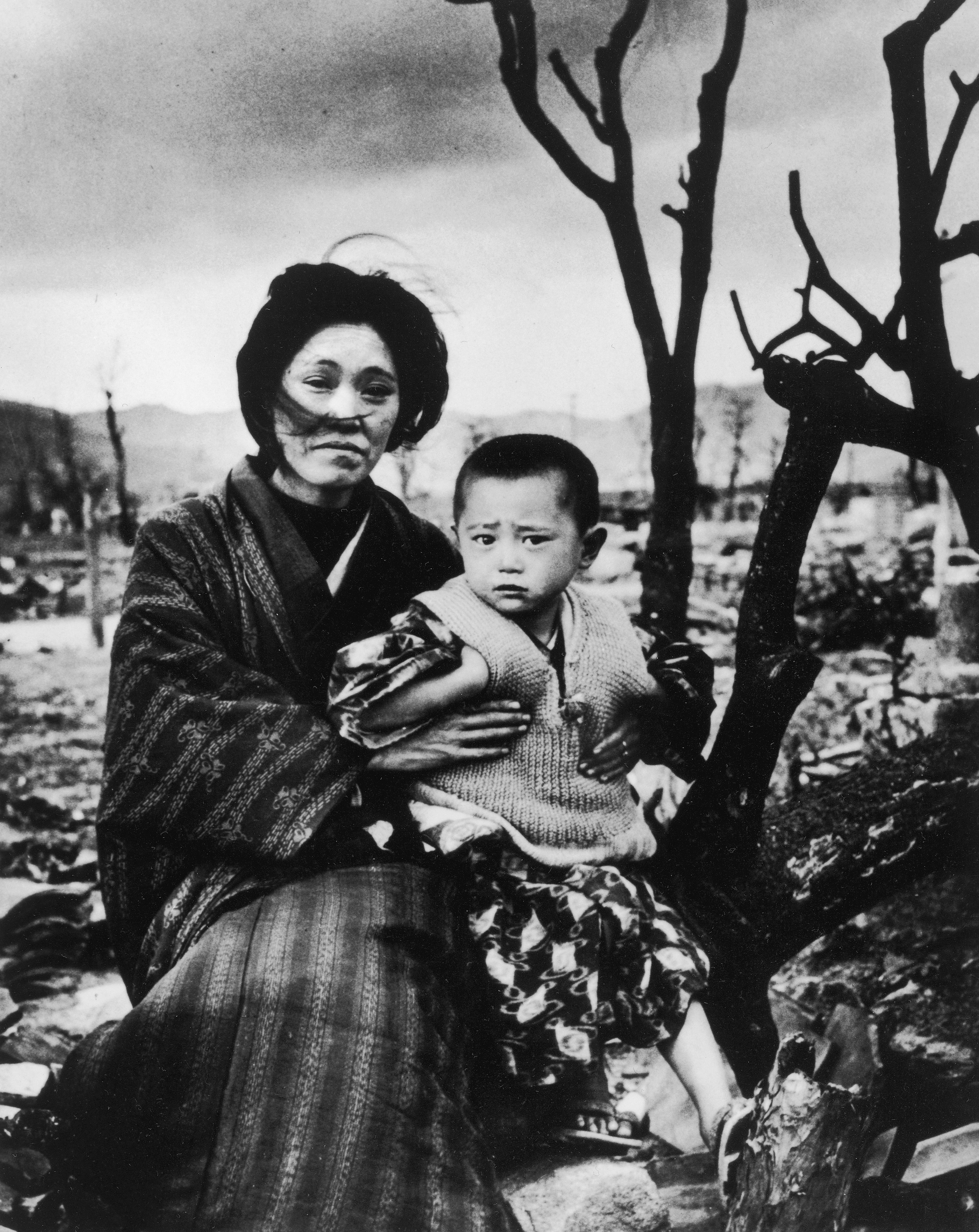 Mãe e filho em Hiroshima, quatro meses após o ataque. (Foto: Alfred Eisenstaedt/Pix Inc./The LIFE Picture Collection/Getty Images)