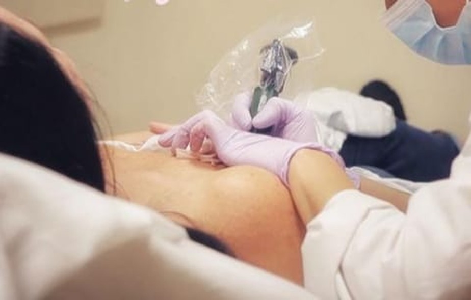 Tatuadora faz reconstrução da aréola do mamilo em paciente que enfrentou câncer de mama.