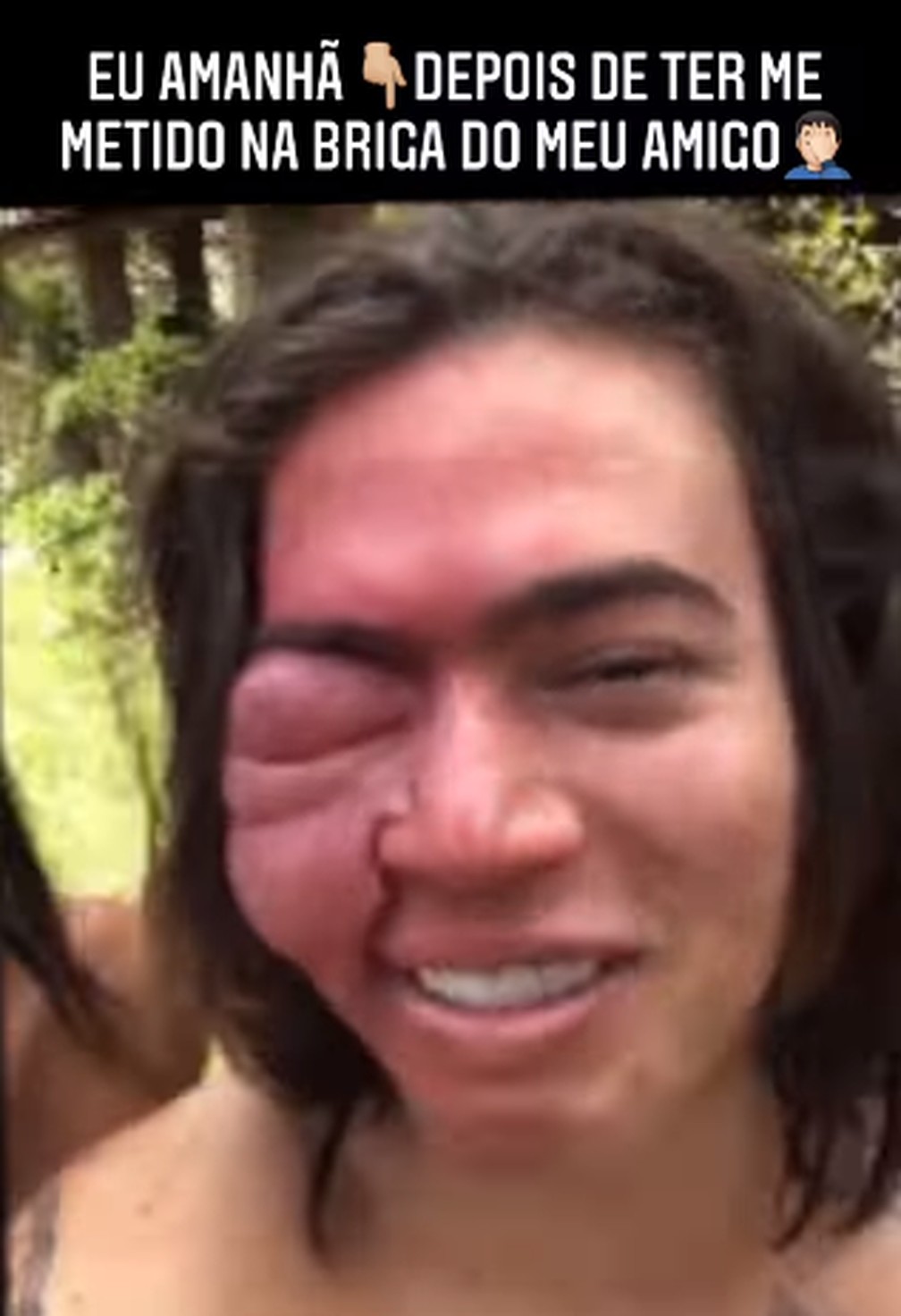 Whindersso x Popó, memes — Foto: Reprodução/Instagram 