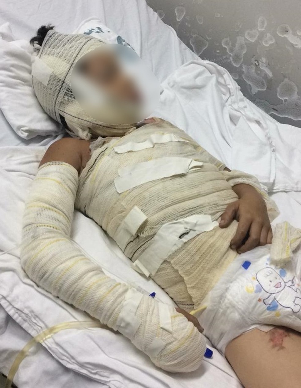 Menino, de 8 anos, teve alta mÃ©dica apÃ³s ter 45% do corpo queimado â Foto: Arquivo pessoal