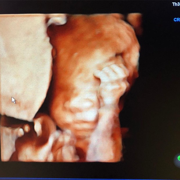 Lizi Benites anuncia nova gravidez (Foto: Reprodução/Instagram)