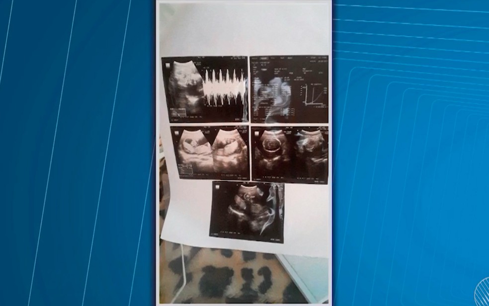 Ultrassom constatou que bebê estava morto na barriga da mãe (Foto: Reprodução/TV Santa Cruz)