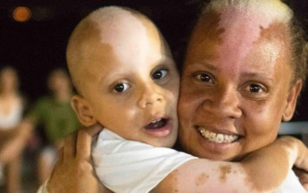 Samuel tem a mesma condição genética da mãe, Nivianei Purificação — Foto: Arquivo pessoal