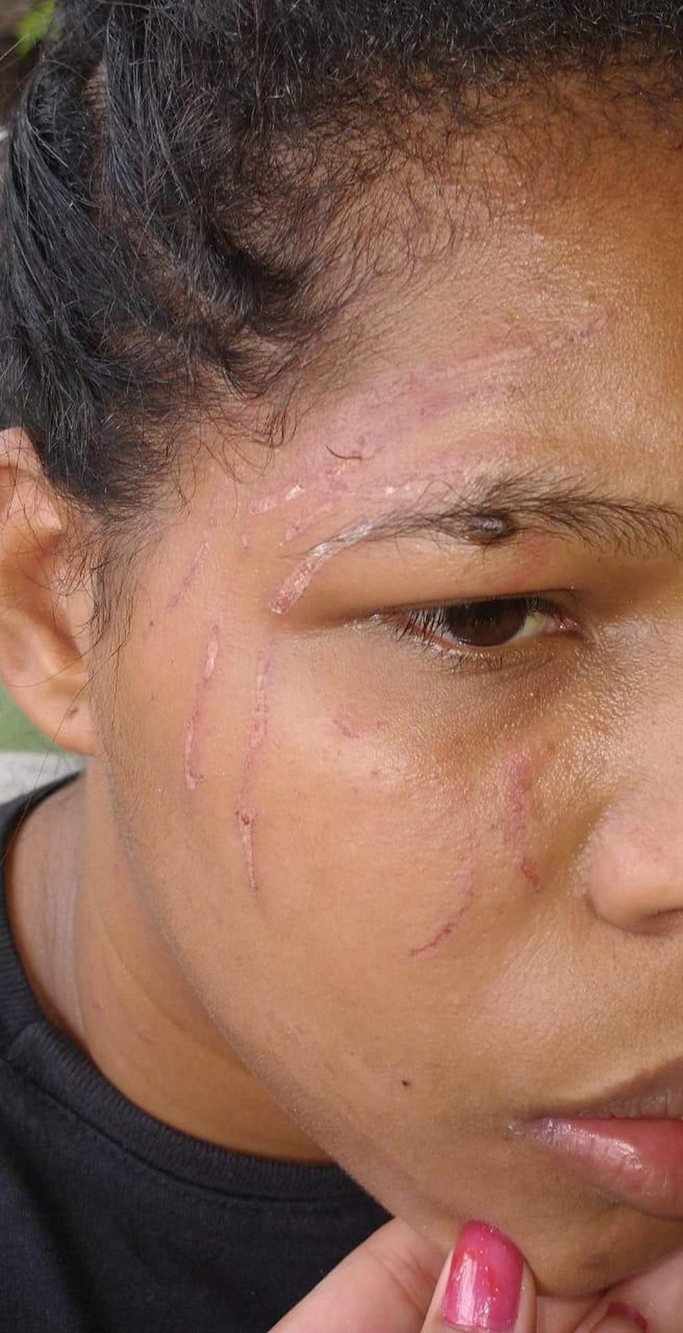 Mulher negra foi chamada de 'macaca preta' e foi arranhada na face, em Penedo, AL — Foto: Arquivo pessoal