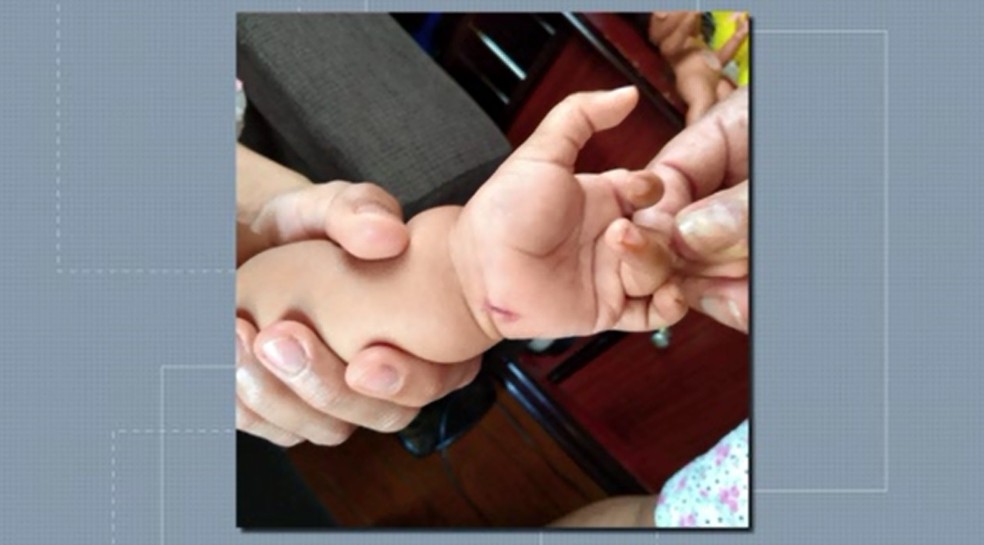 BebÃª de um ano e dois meses foi atingida por trÃªs golpes de faca pelo prÃ³prio pai, em RolÃ¢ndia â€” Foto: ReproduÃ§Ã£o/RPC