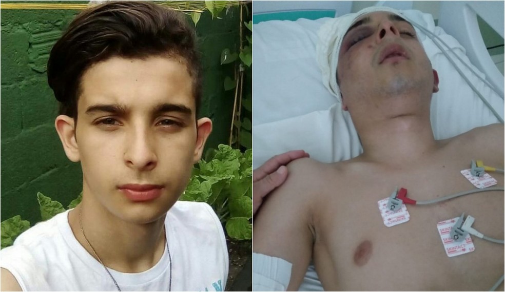 Jovem fica paralisado ao ser agredido dentro de ala psiquiátrica de hospital no litoral de SP