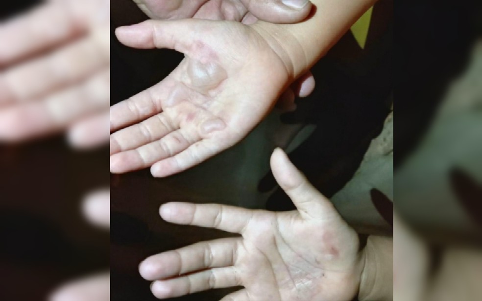Mãe é suspeita de queimar mãos das filhas como castigo por comerem uma caixa de leite condensado em Rio Verde, Goiás — Foto: Reprodução/TV Anhanguera