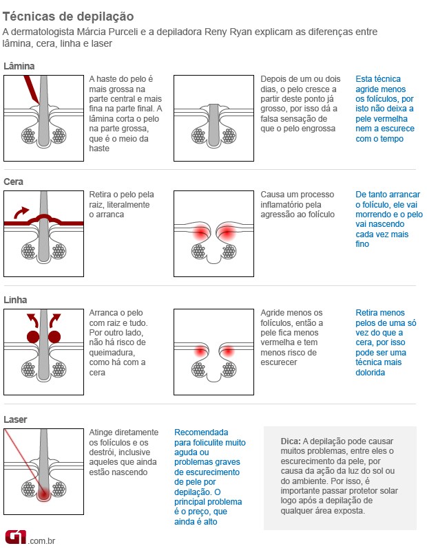 Dicas para depilação das partes íntimas - CCM Saúde