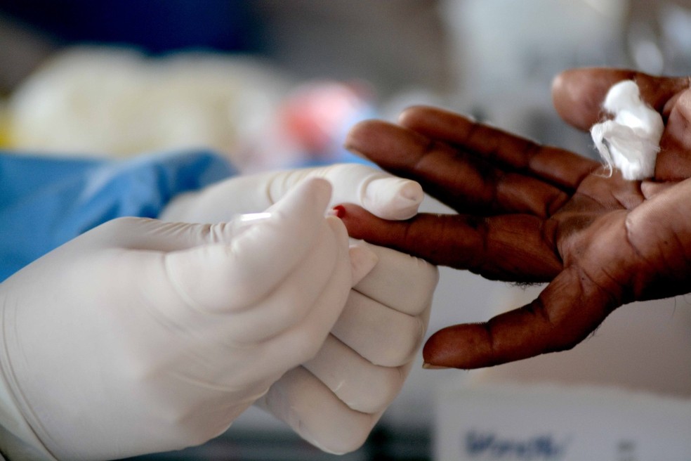 Testes para coronavírus — Foto: Jefferson Peixoto/Secom
