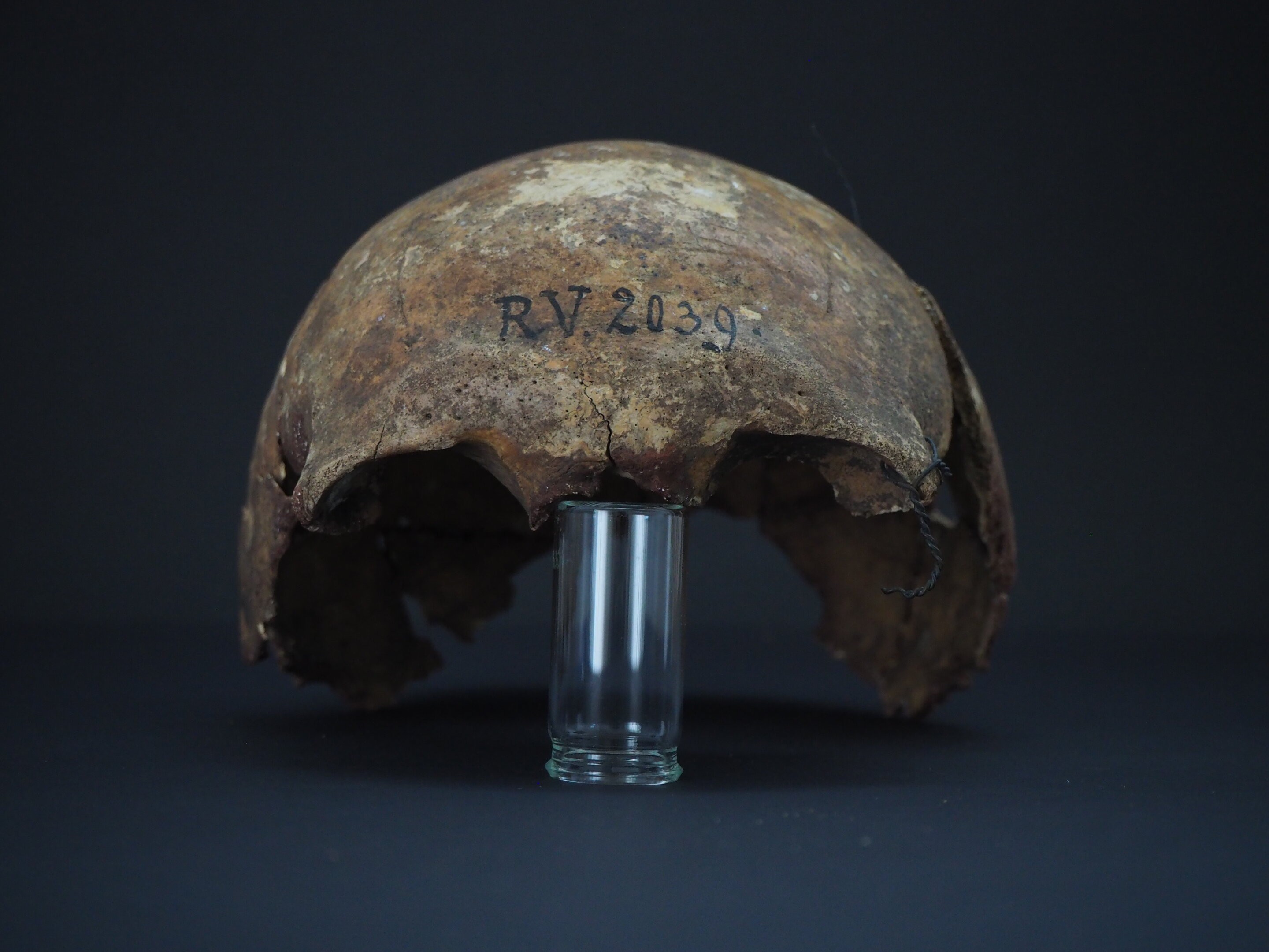 Esqueleto de 5 mil anos contém cepa mais antiga da Peste Negra (Foto: Dominik Göldner/BGAEU)