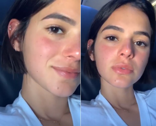Bruna Marquezine mostra alergia em voo (Foto: Reprodução Instagram)