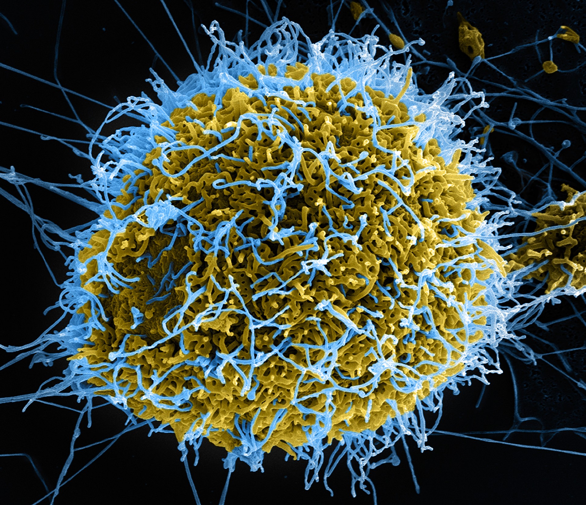 Célula infectada com vírus do ebola (Foto: flickr/creative commons/ niaid)