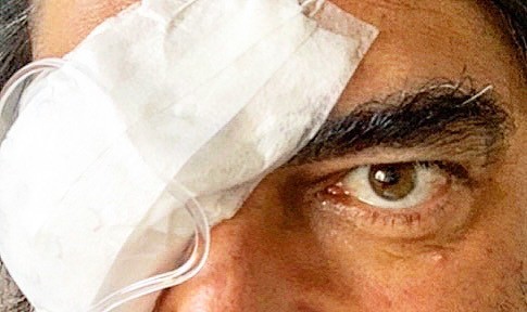 Zeca Camargo passa por cirurgia em olho (Foto: Reprodução/Instagram)