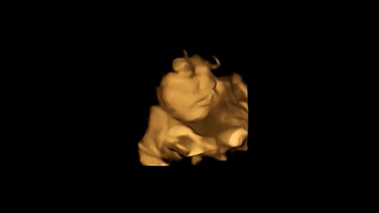 Imagem de varredura 4D mostra um feto no útero  (Foto: Estudo FETAP (Fetal Taste Preferences)/Laboratório de Pesquisa Fetal e Neonatal/Universidade de Durham)