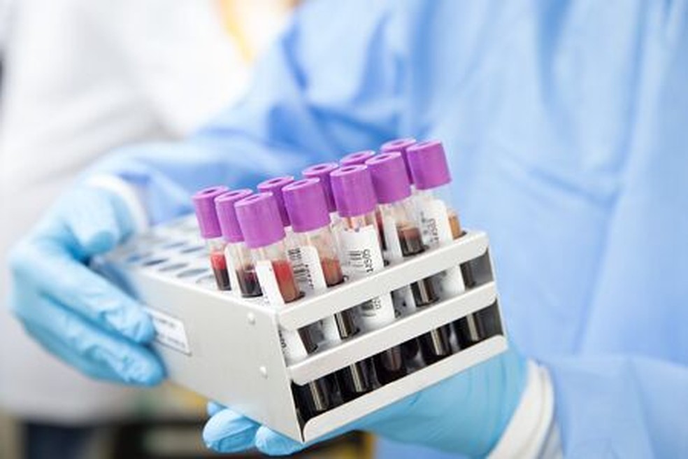Exames para detectar varíola doa macacos  — Foto: Ahmad Ardity por Pixabay 
