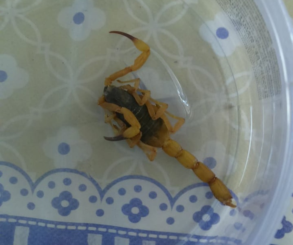 Menina de 11 anos foi vítima de escorpião amarelo em Lins — Foto: Arquivo pessoal/Augusto Sérgio dos Santos Brito