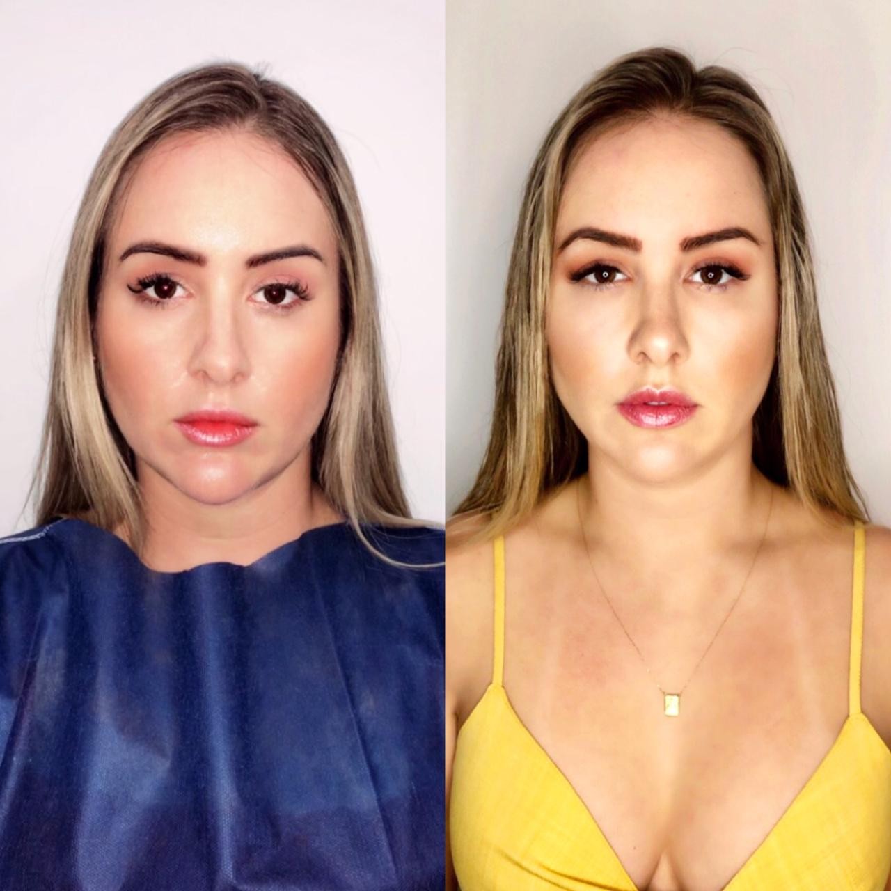 Patrícia Leitte: antes e depois  (Foto: Reprodução)