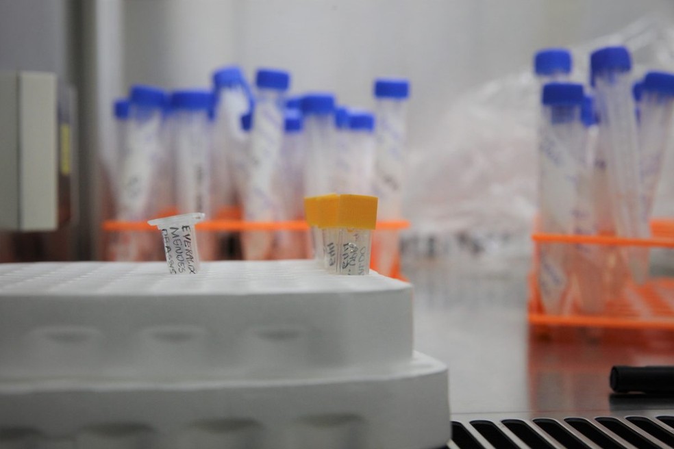 Acre tem 22 exames de RT-PCR à espera de análise do Laboratório Central de Saúde Pública do Acre (Lacen) ou do Centro de Infectologia Charles Mérieux — Foto: Odair Leal/Secom