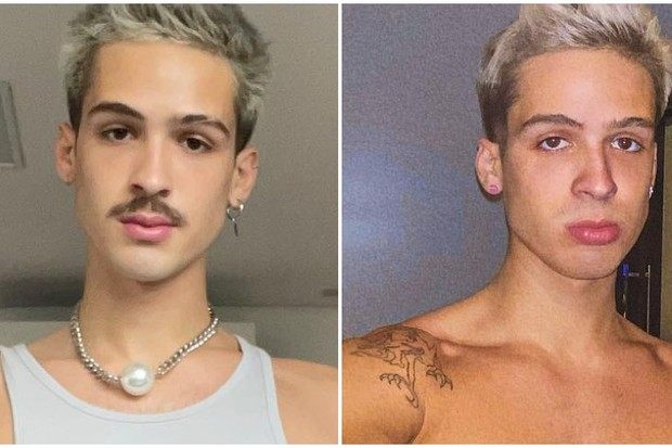 O antes e depois de João Guilherme (Foto: Instagram/Reprodução)